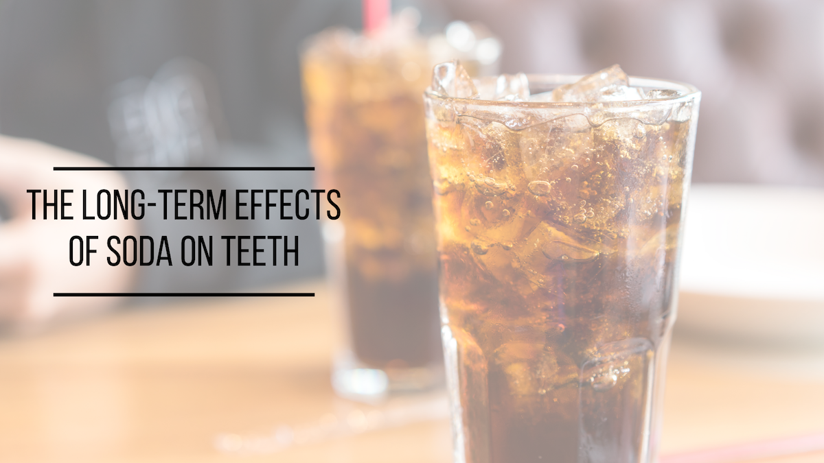 The Long-Term Effects of Soda on Teeth