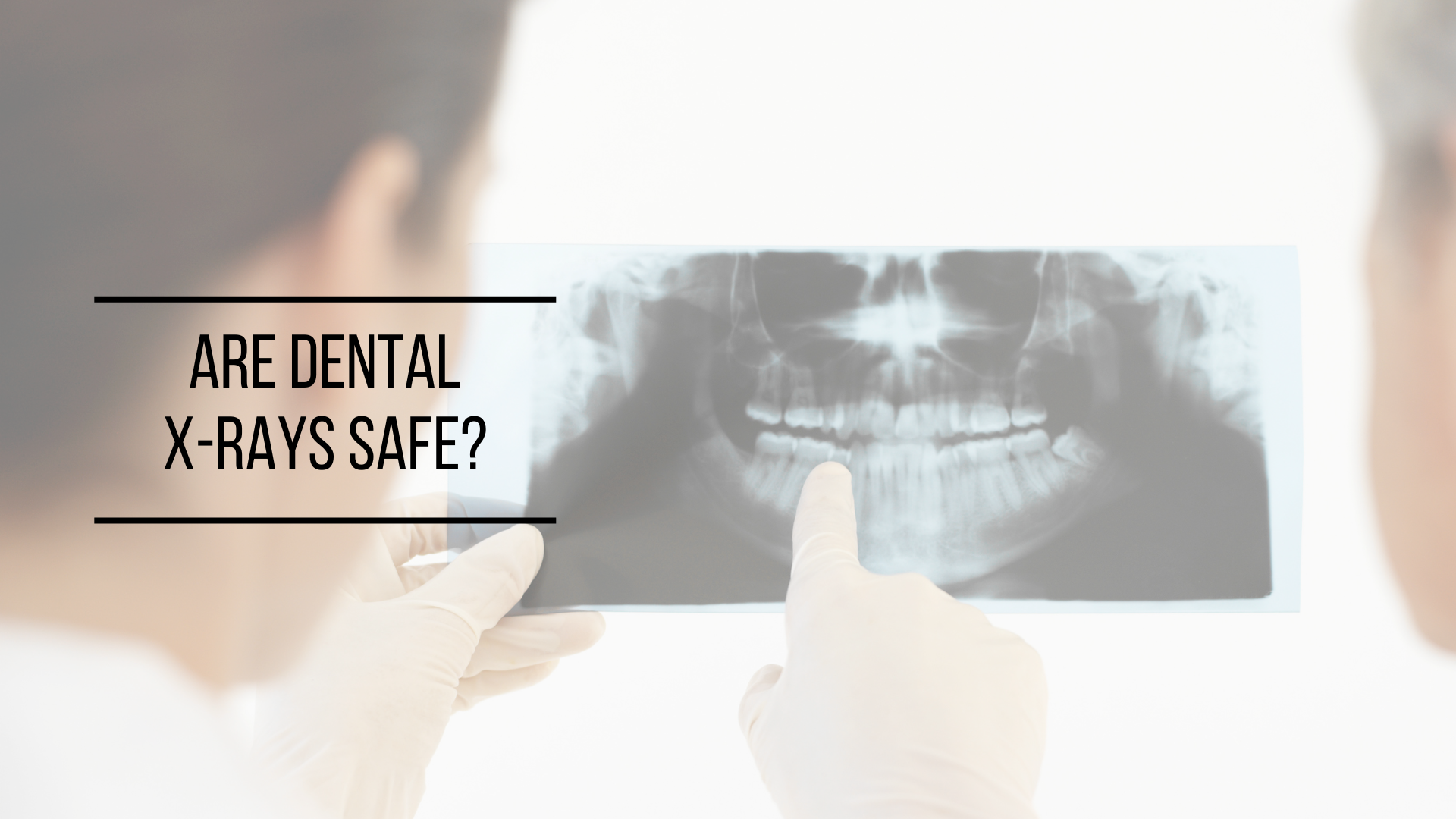 Are Dental X-Rays Safe?